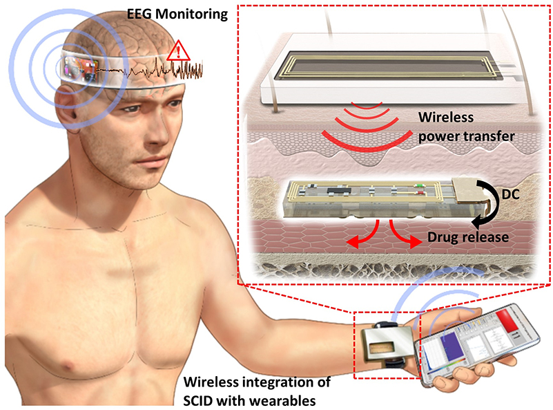 Wireless Soft Bioelectronics